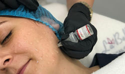 Пілінг JPX3 bio - неін&acuteєкційний біостимулятор для обличчя та тіла