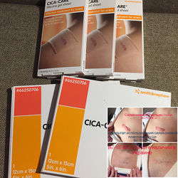 CICA-CARE Для коригування шрамів та рубців. У дорослих і дітей.